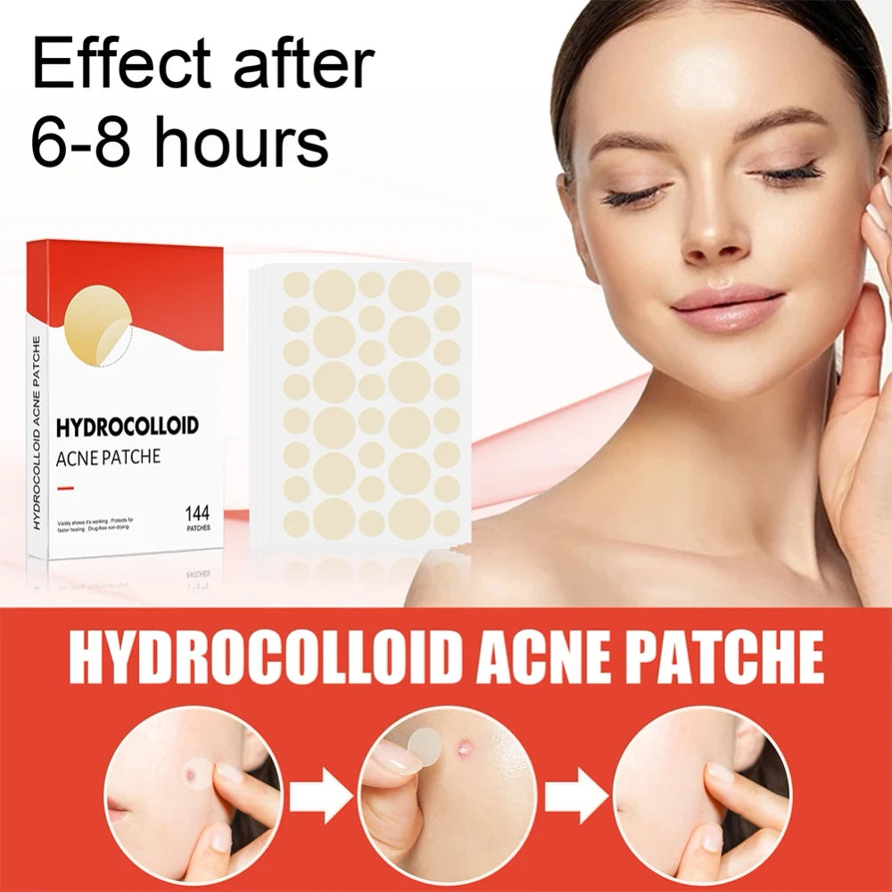Acne Pimple Patches 144-Count