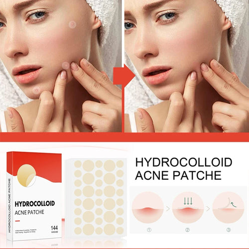 Acne Pimple Patches 144-Count
